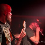 0021 Congenital Anomalies